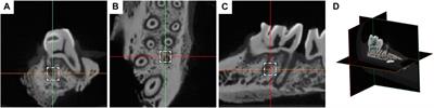 Effect of local application of bone morphogenetic protein -2 on experimental tooth movement and biological remodeling in rats